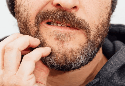 Éliminer les Pellicules de Barbe : Conseils Pratiques | Monsieur Arsène